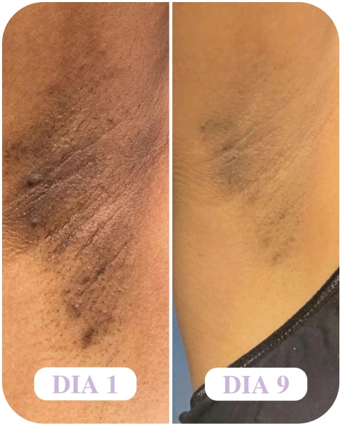 12 → Picture → 1-scaled.png.webp